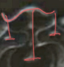 20250109_195630.jpg