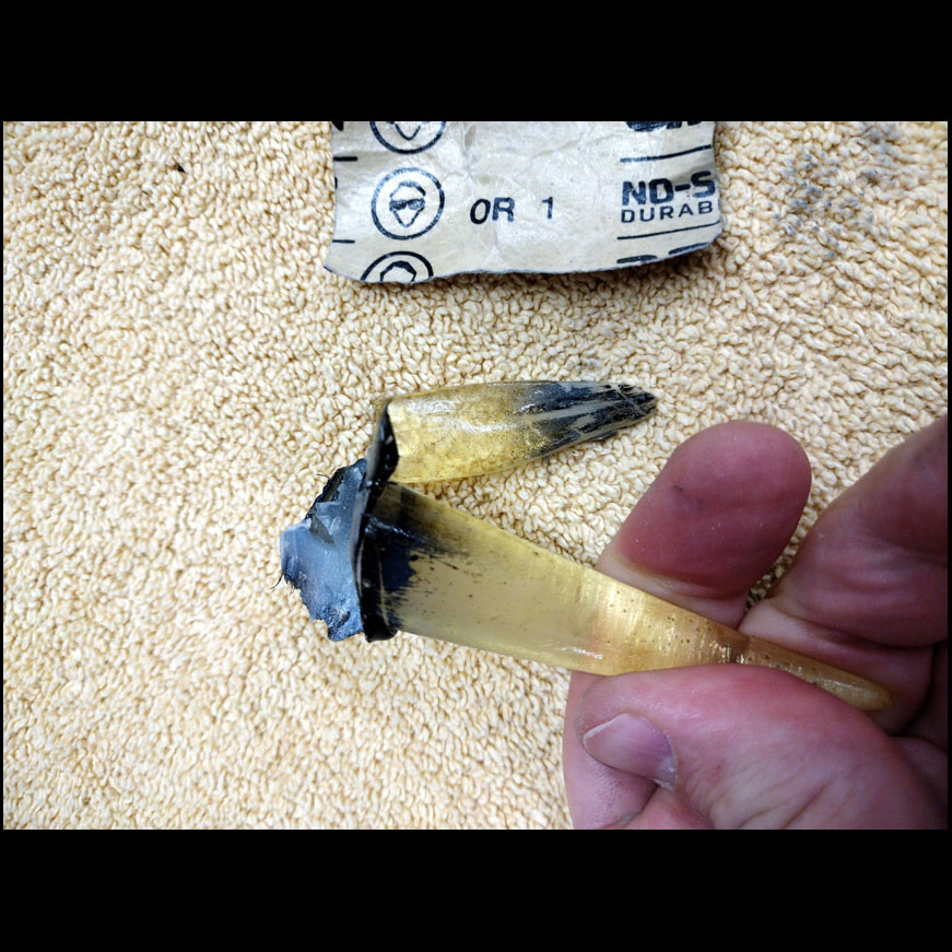 23,01-09 (21)sanding black off tooth.jpg