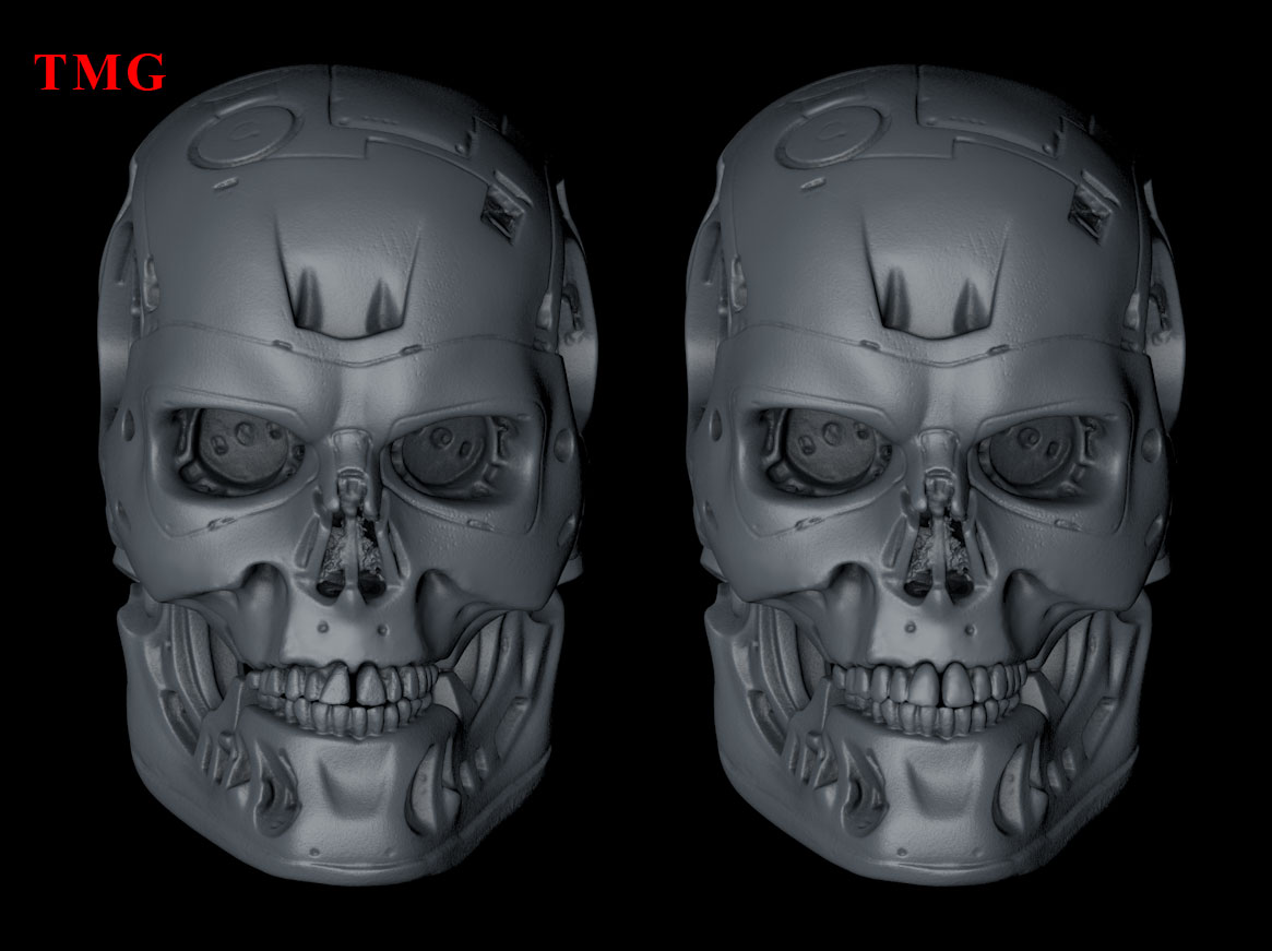 3D-Scan-LFS-Teeth-vs-TMG-Fix-Teeth-001.jpg