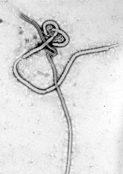 424px_Ebola_virus_em.jpg