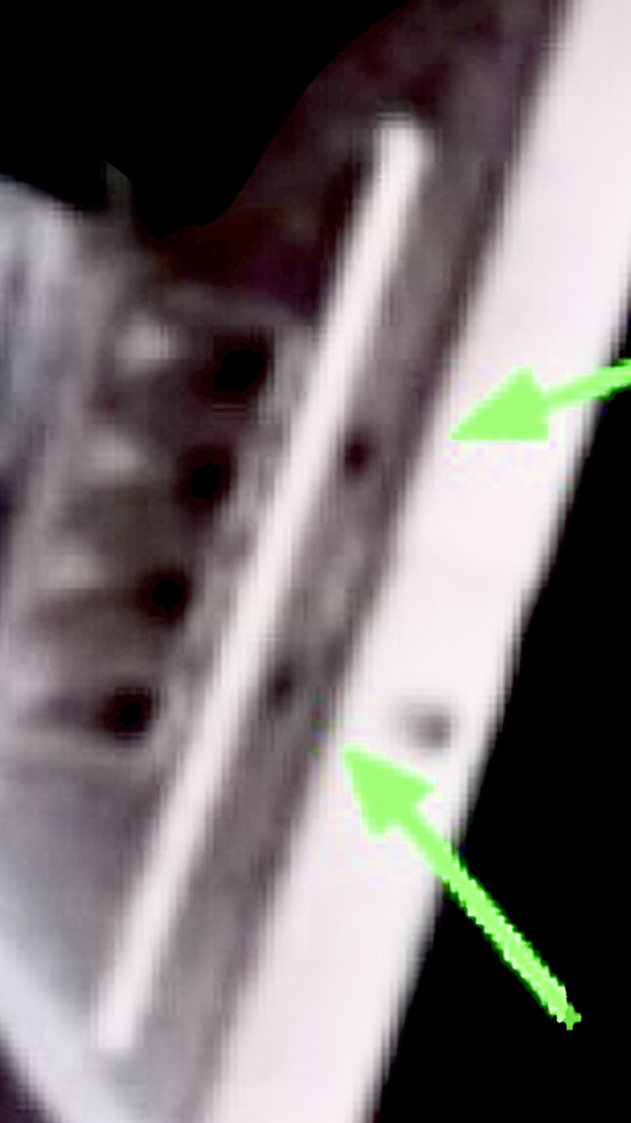 860C0619-7028-427E-87C4-A7B8707AC584.png