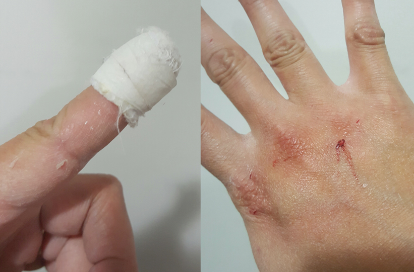 bleed-for-pred.jpg