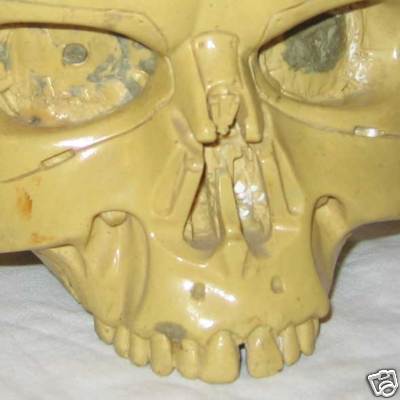 Endo Skull - T1 Reject - 002.jpg