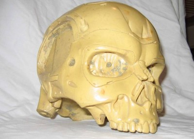 Endo Skull - T1 Reject - 003.jpg