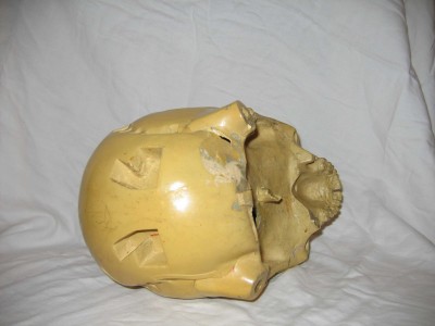 Endo Skull - T1 Reject - 008.jpg