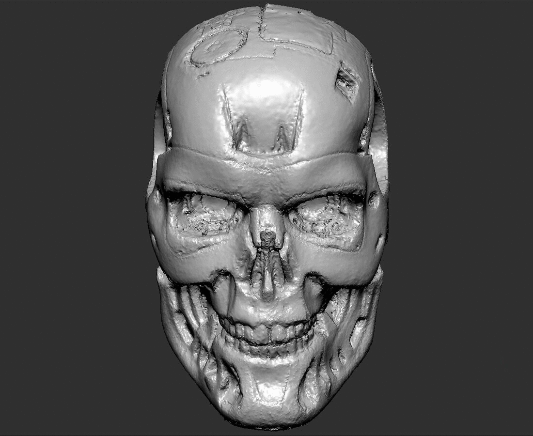 EndoSkull3D_T1.gif