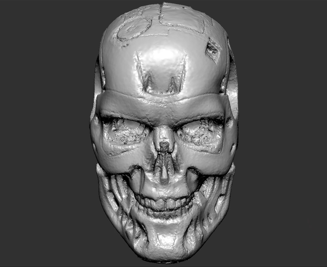 EndoSkull3D_T1.jpg