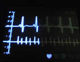 heart.png