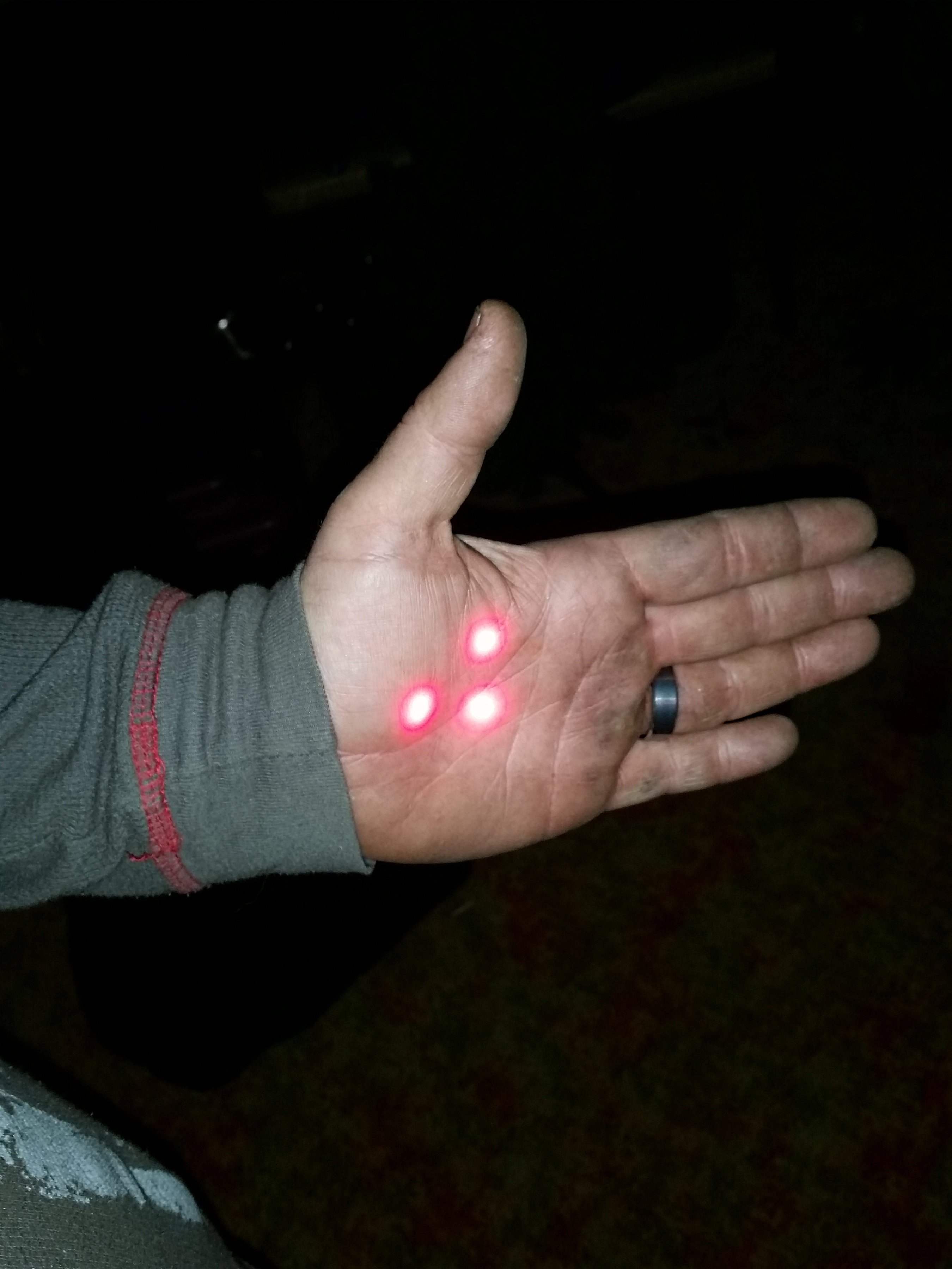 Lasers.jpg