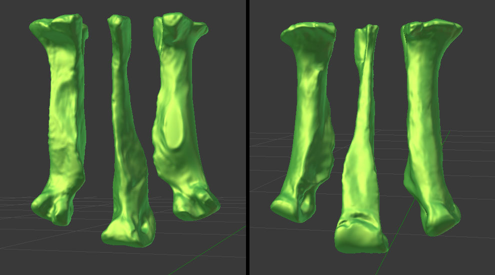 metatarsals_separated_by_strick67-dcesrxb.jpg
