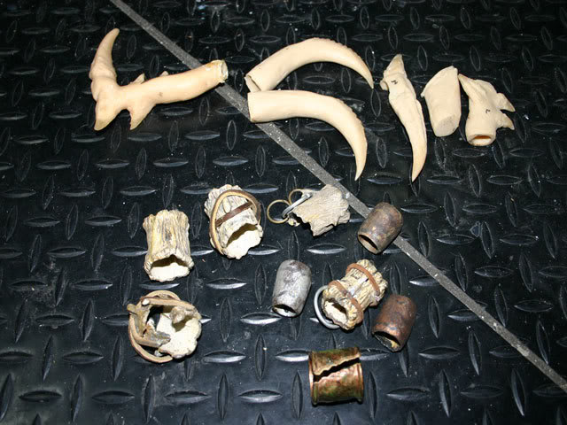 p2teethandrings.jpg