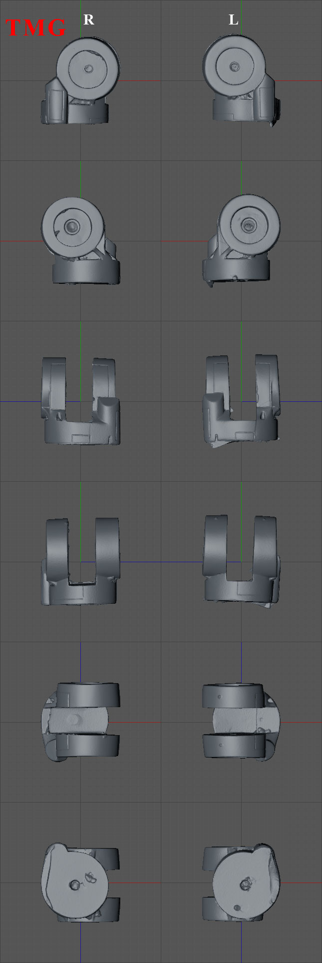 Shoulder-L-and-R.jpg