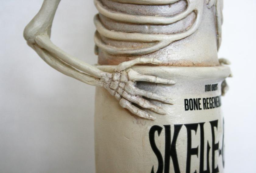 skele4-841x567.jpg