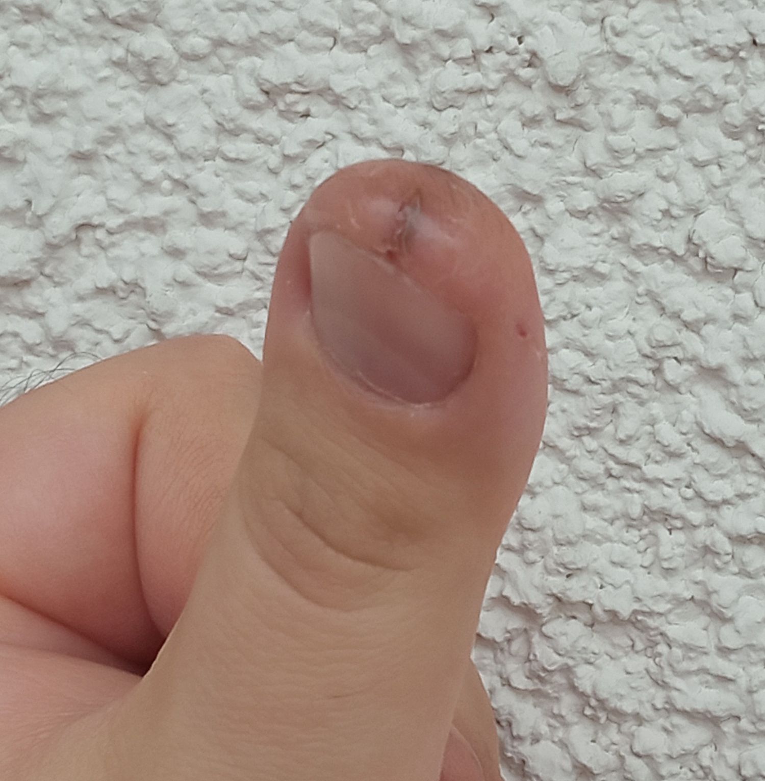 superglue.jpg