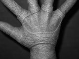 th_20110902-P1RH-FinalDetailBack.jpg