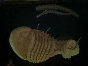 body