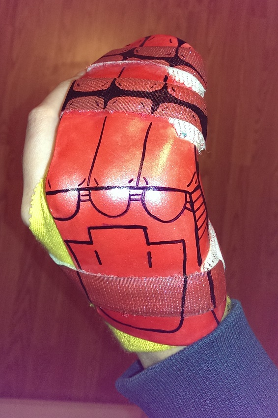 Broken finger 2015: when life hands you lemons, become Iron Man.