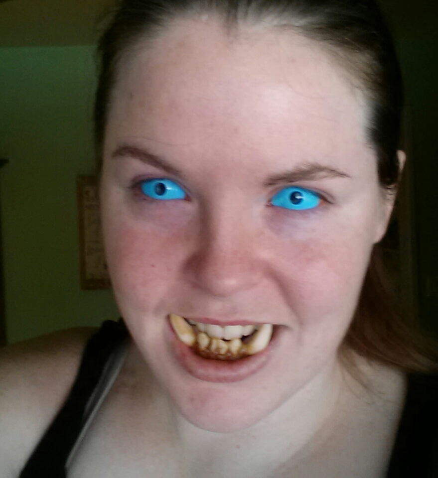 Yay contacts
Dental Distortions